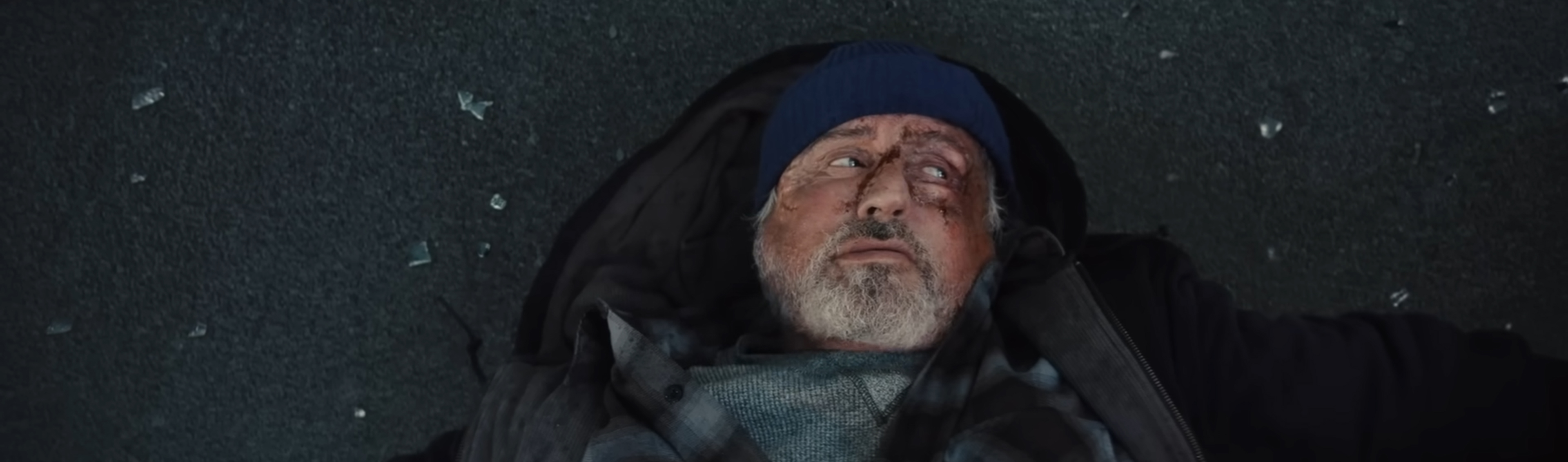 Joe on his back after getting hit by a car.